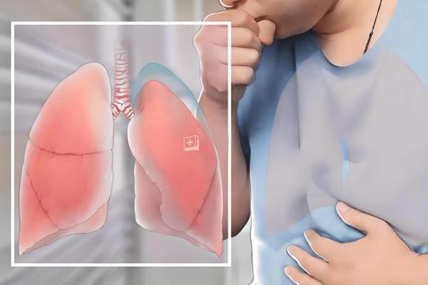 呼吸道防护指南:2026年西方兑宫养护法 呼吸道防护指南:2026年西方兑宫养护法