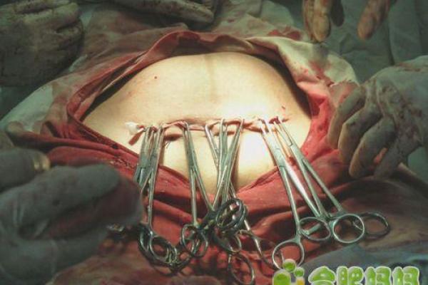 2026年5月剖腹产最吉利的三天，准爸妈必看