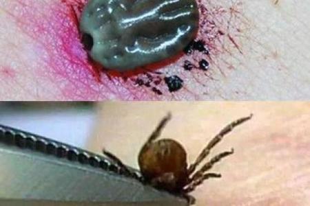 女人梦见身上有扯不完的虫子
