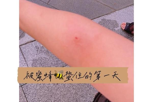 梦见被蜂子追着蛰预示什么